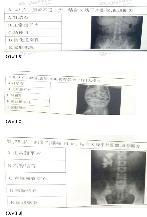 临床执业助理医师实践技能多媒体考试14大样题参考！