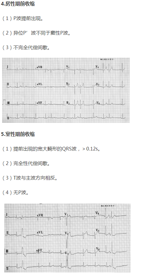 房型前期收缩