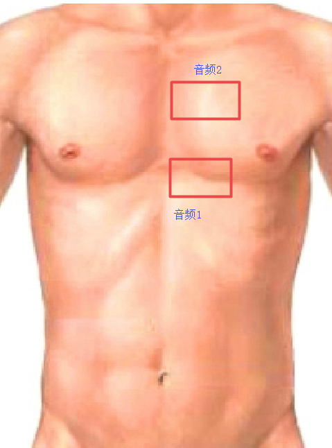  动脉导管未闭（连续机器样杂音）-临床助理医师技能模拟试题