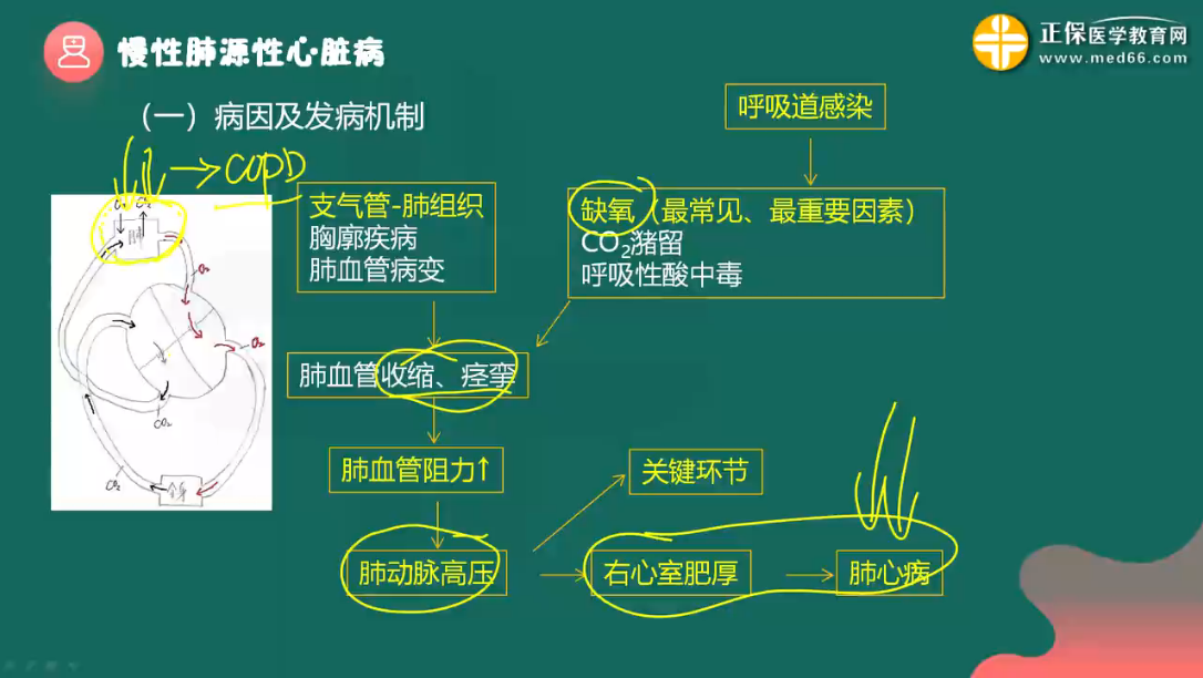 【初级护师】慢性肺源性心脏病的发病机制、临床表现