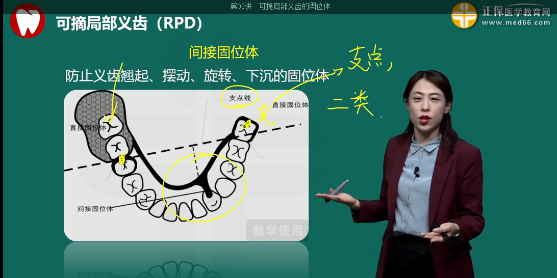 2023年口腔主治医师考试考点回顾：间接固位体