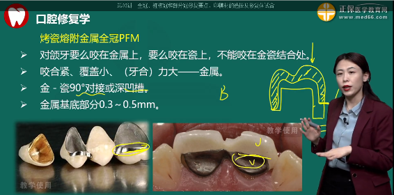 2023年口腔主治医师考试考点回顾：烤瓷熔附金属全冠贵金属基底冠厚度