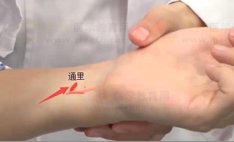 中西医助理医师实践技能针灸常用腧穴：手少阴心经（通里）