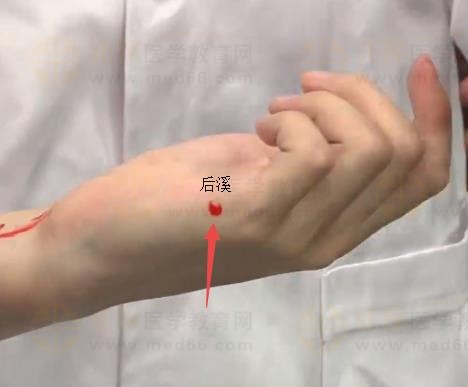 中西医助理医师实践技能针灸常用腧穴：手太阳小肠经（后溪）