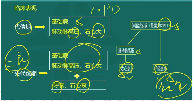 慢性肺源性心脏病临床表现